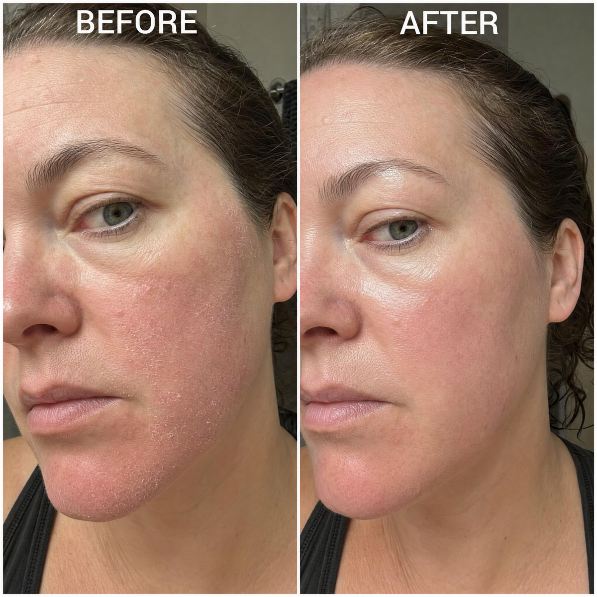 Second Skin Barrier Lipid Serum