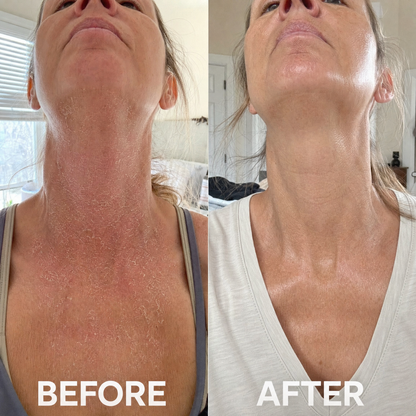 Second Skin Barrier Lipid Serum