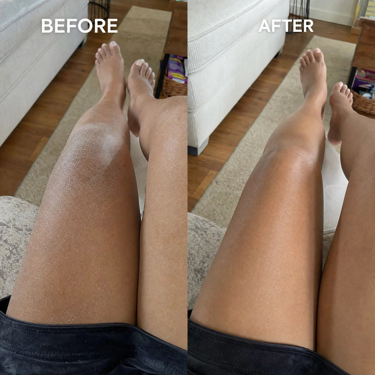 Second Skin Barrier Lipid Serum